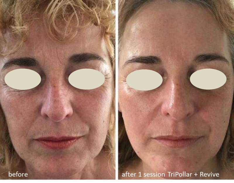 czM6Ly9tZWRpYS1wcml2YXRlLmNhbnZhLmNvbS9fVG9Tby9NQUZ2TkJfVG9Tby8xL3AucG5n