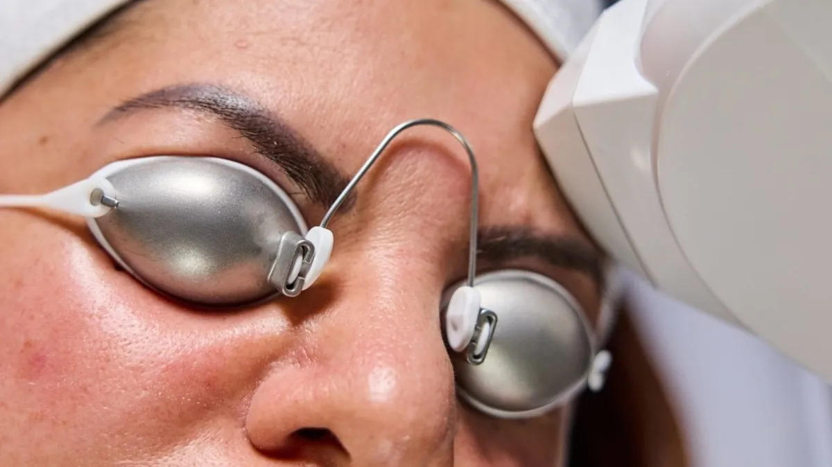 A Female receiving Laser Skin Rejuvenation at Vertex Aesthetics in Toronto, ON