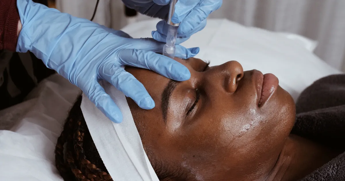 Woman with Microneedling Treatment
