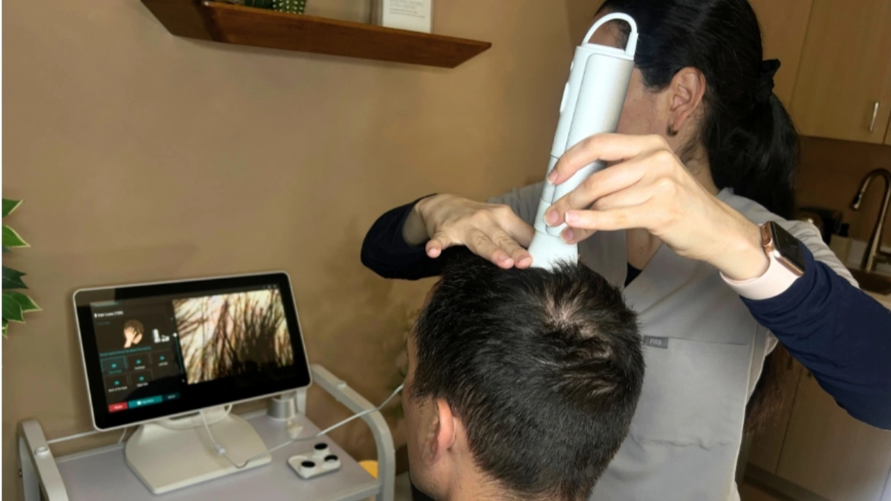 Hair Thinning treatment in Toronto
